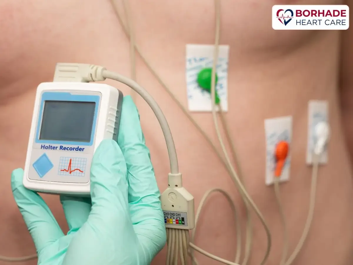 Holter test machine is connected to body.