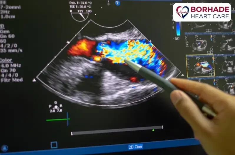 2D echo screen visual.