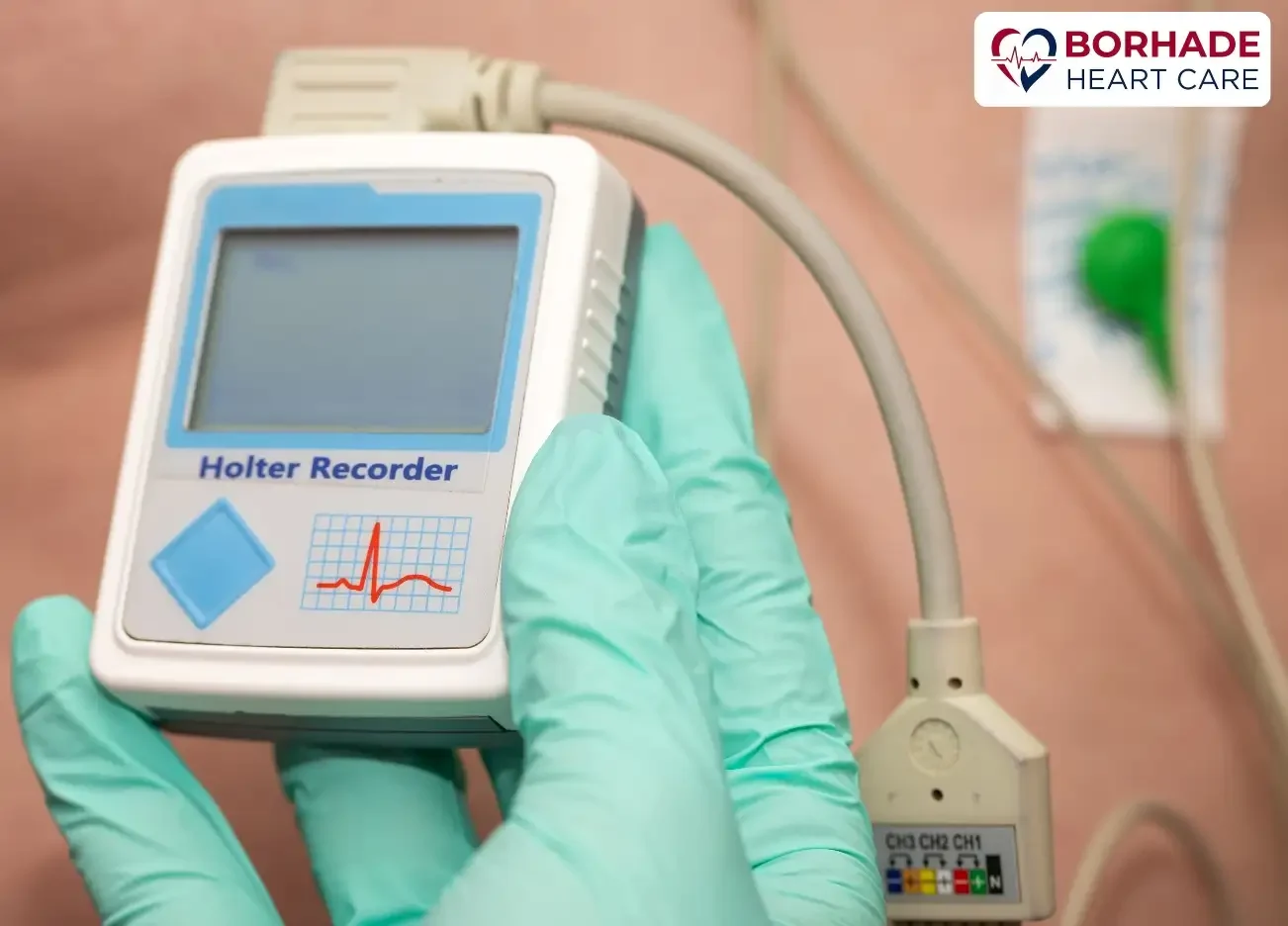 A holter monitor device.