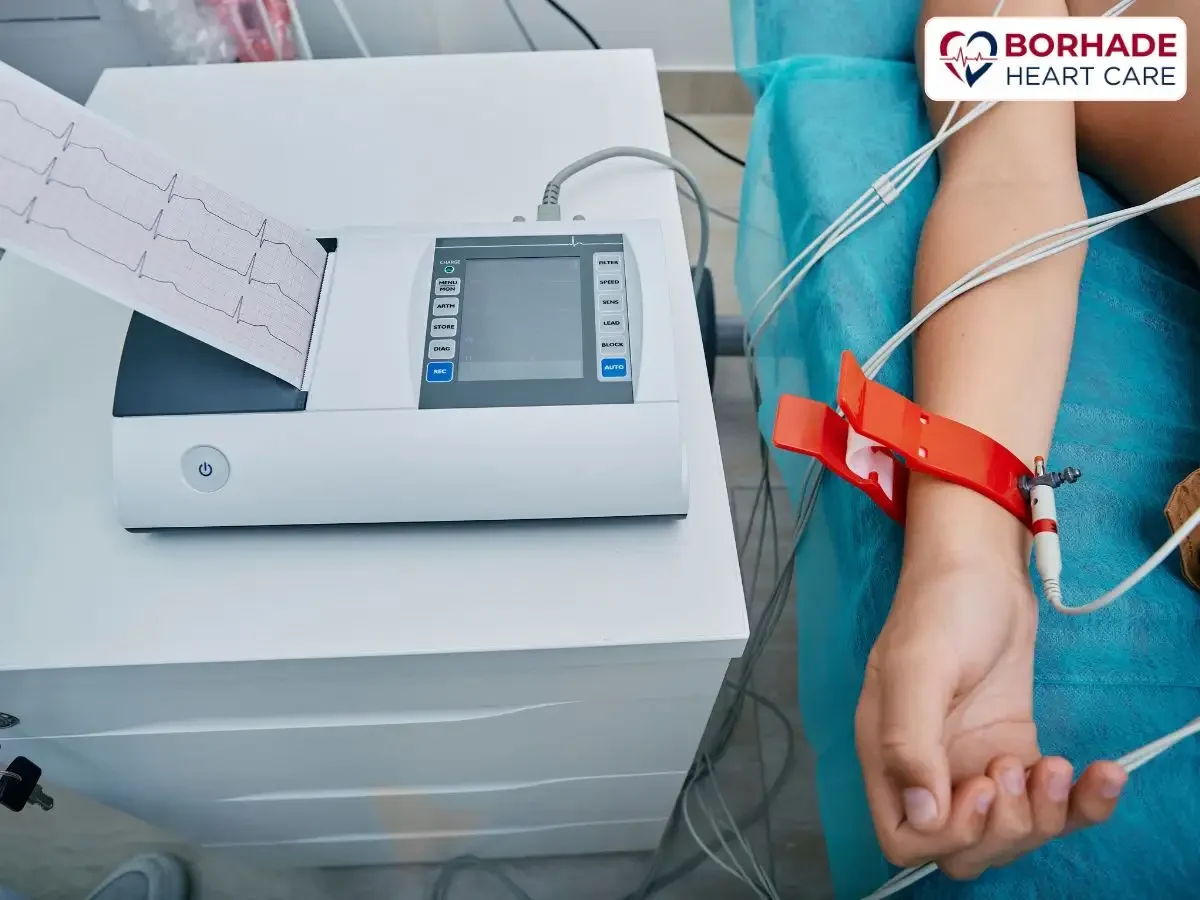 ECG report being printed on ECG Machine.