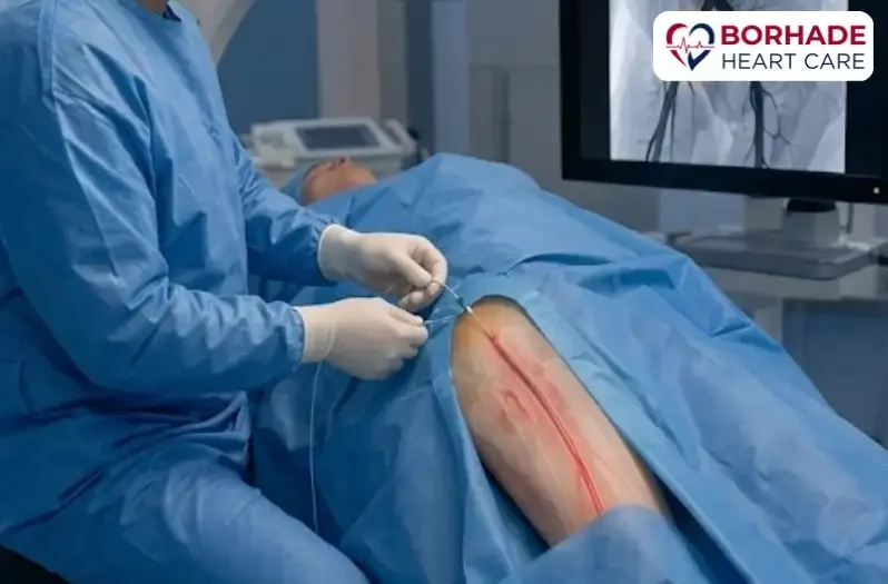 Dr. Ajinkya Borhade performing femoral angioplasty from leg.