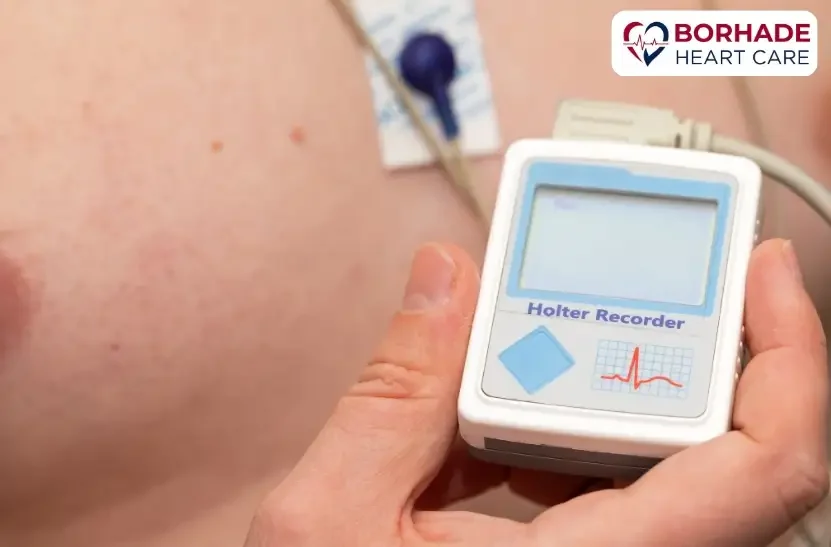 Holter Test in Pune by Dr. Ajinkya Borhade