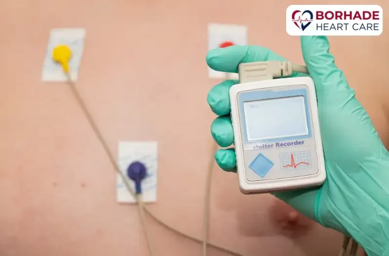 A holter monitor device.