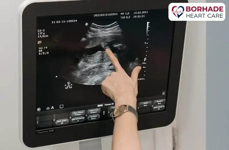 Visuals of Transesophageal Echocardiography.