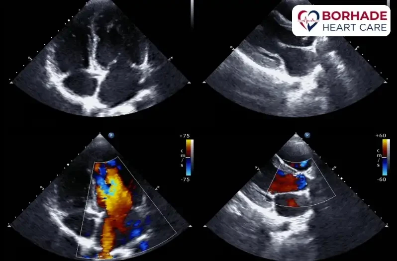 Visuals of Transthoracic Echocardiography.